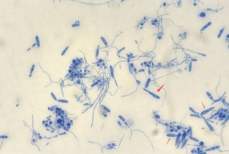 这三种真菌在显微镜下的模样十分相似,都是由若干个小孢子排列形成