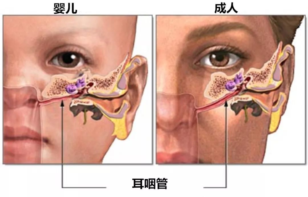 区分油耳和中耳炎图片图片