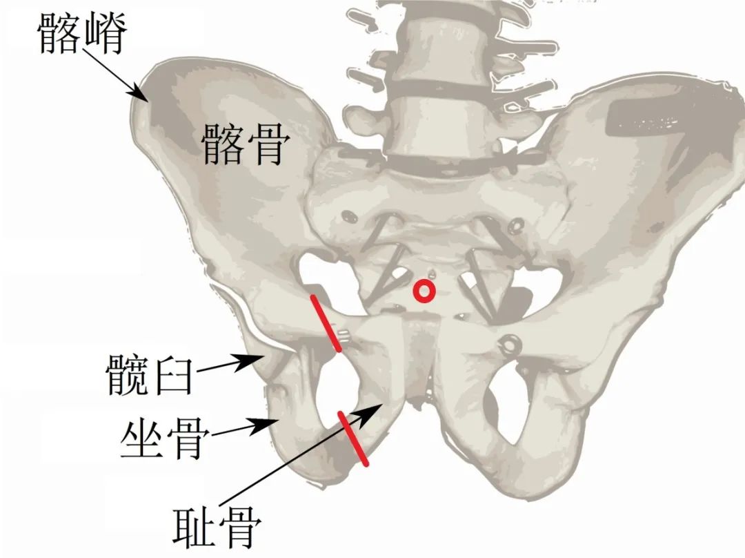 真骨盆标志图片