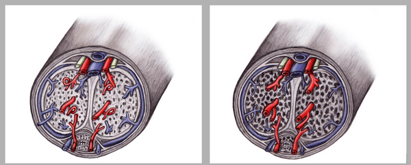 阴茎松弛状态(左)与勃起时（右）的示意图，注意代表动脉的红色血管与代表静脉的蓝色血管状态的差异。（图片来自emedicine.medscape.com）
