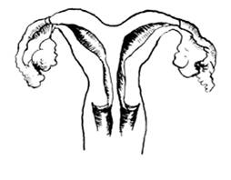 图为双阴道双子宫畸形 图片来自 www.glowm.com