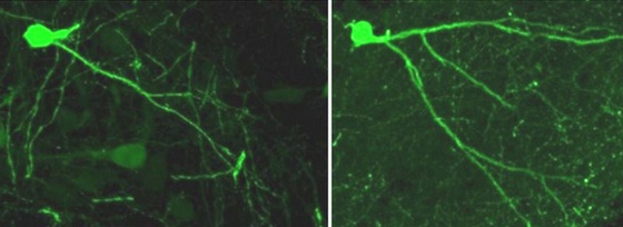 紧张沮丧情绪下的小鼠表现出神经元活性降低的现象（左），但在影响其神经突蛋白之后小鼠的神经元活性又恢复到了正常水平（右）。